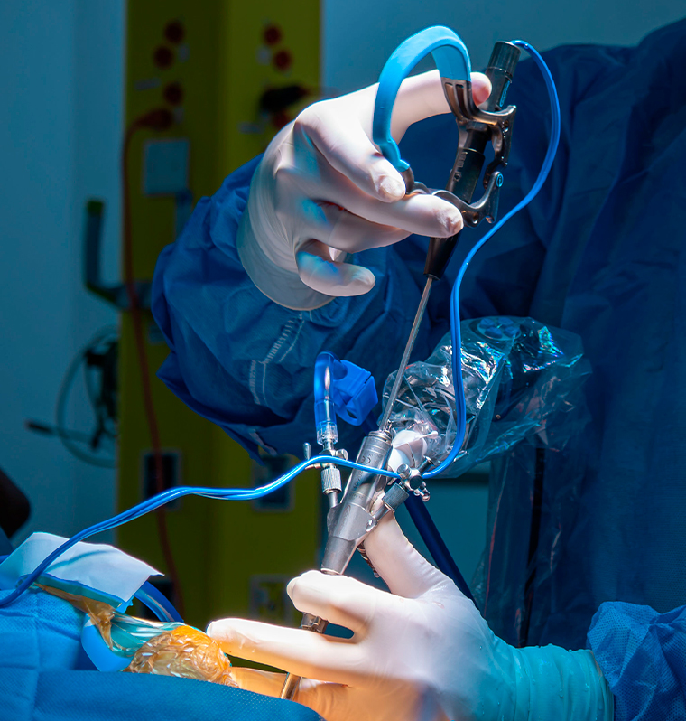 Endoscopio de columna para cirugía espinal de mínima invasión del Dr. Radovan Sancevic